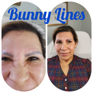 bunny-lines