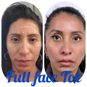 full-face-tox